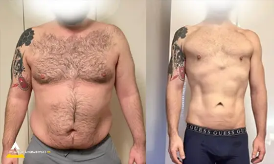 Przemiana podopiecznego, zdjęcie przed i po